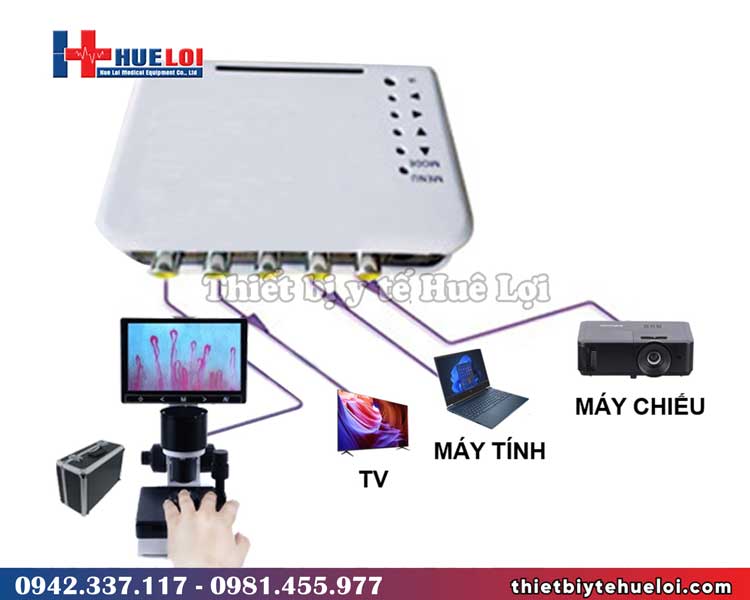 Kính hiển vi soi mạch máu độ phân giải cao